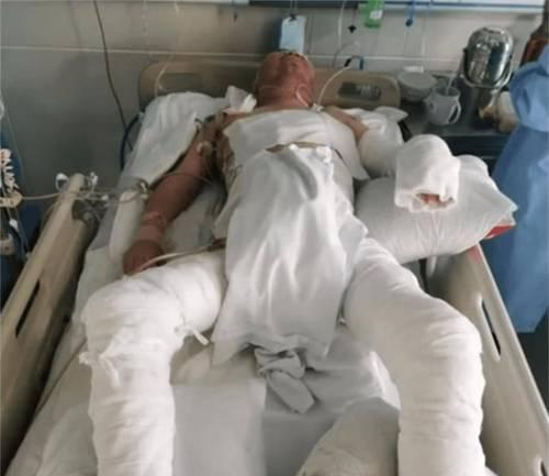绝地求生中被火烧到的应对策略？如何避免被火烧伤？