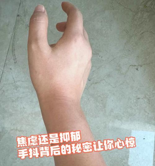 绝地求生手发抖是什么原因？如何解决手发抖问题？